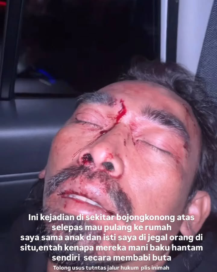kampfirevampire's tweet photo. KARENA SAMPAI SEKARANG PELAKU NYA BELUM DI TANGKAP !!!

-BANTU VIRALKAN-

Pegiat motor trail dan pengusaha kopi, Ferly Renaldi (39) atau lebih dikenal Dudung SP menjadi korban pengeroyokan oleh orang tidak dikenal (OTK) di wilayah Cimenyan, Kabupaten Bandung. https://t.co/8ZChycNc7U