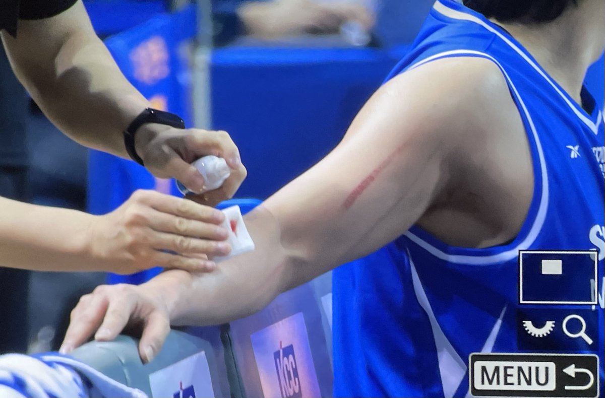 아니 너무 심하잖아 이정현 걍 살이 패임 피가 질질 나