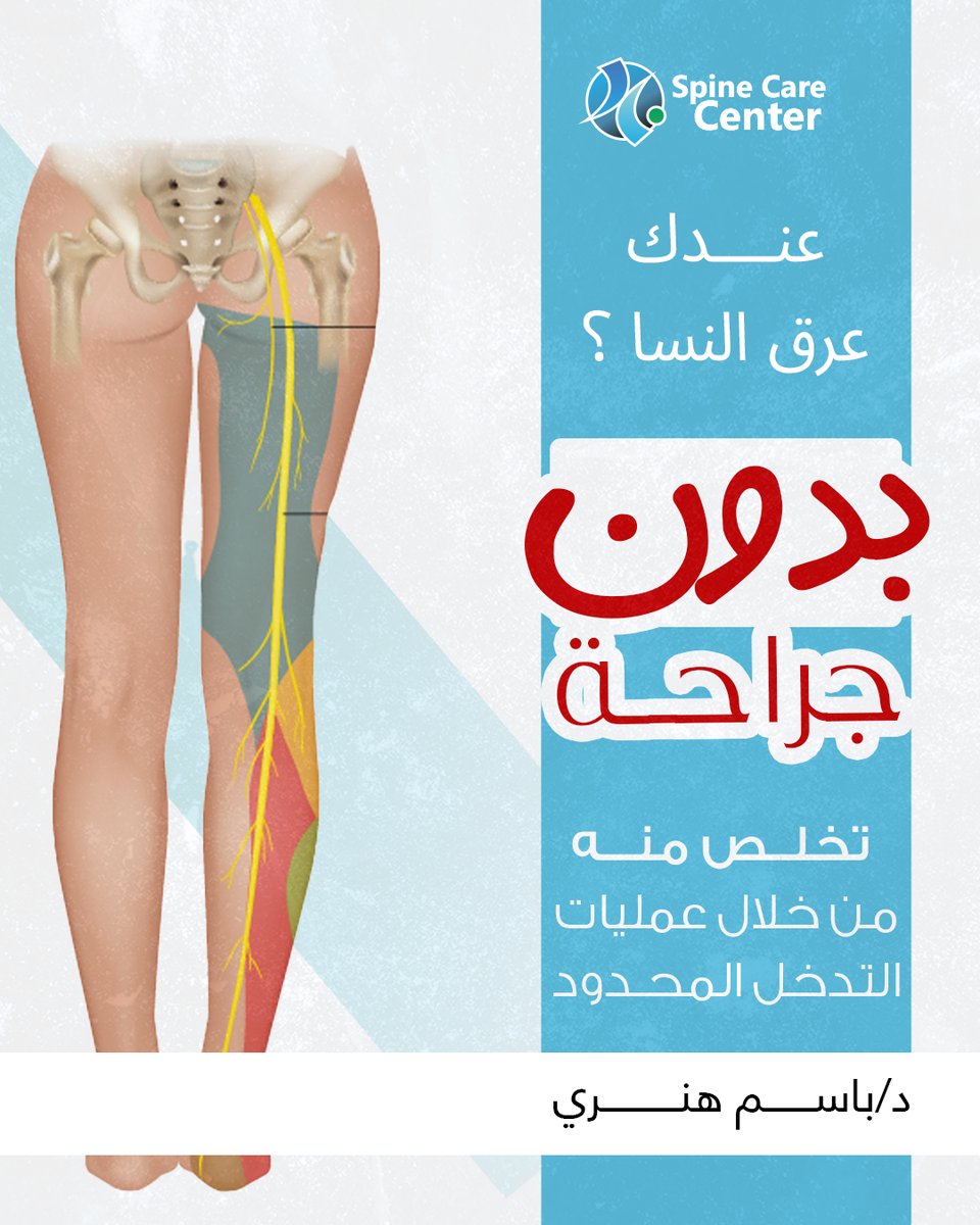 تخلص من عرق النسا دلوقتي بدون جراحة
من خلال تقنيات التدخل المحدود المختلفة 
ومن خلال التخدير الموضعي