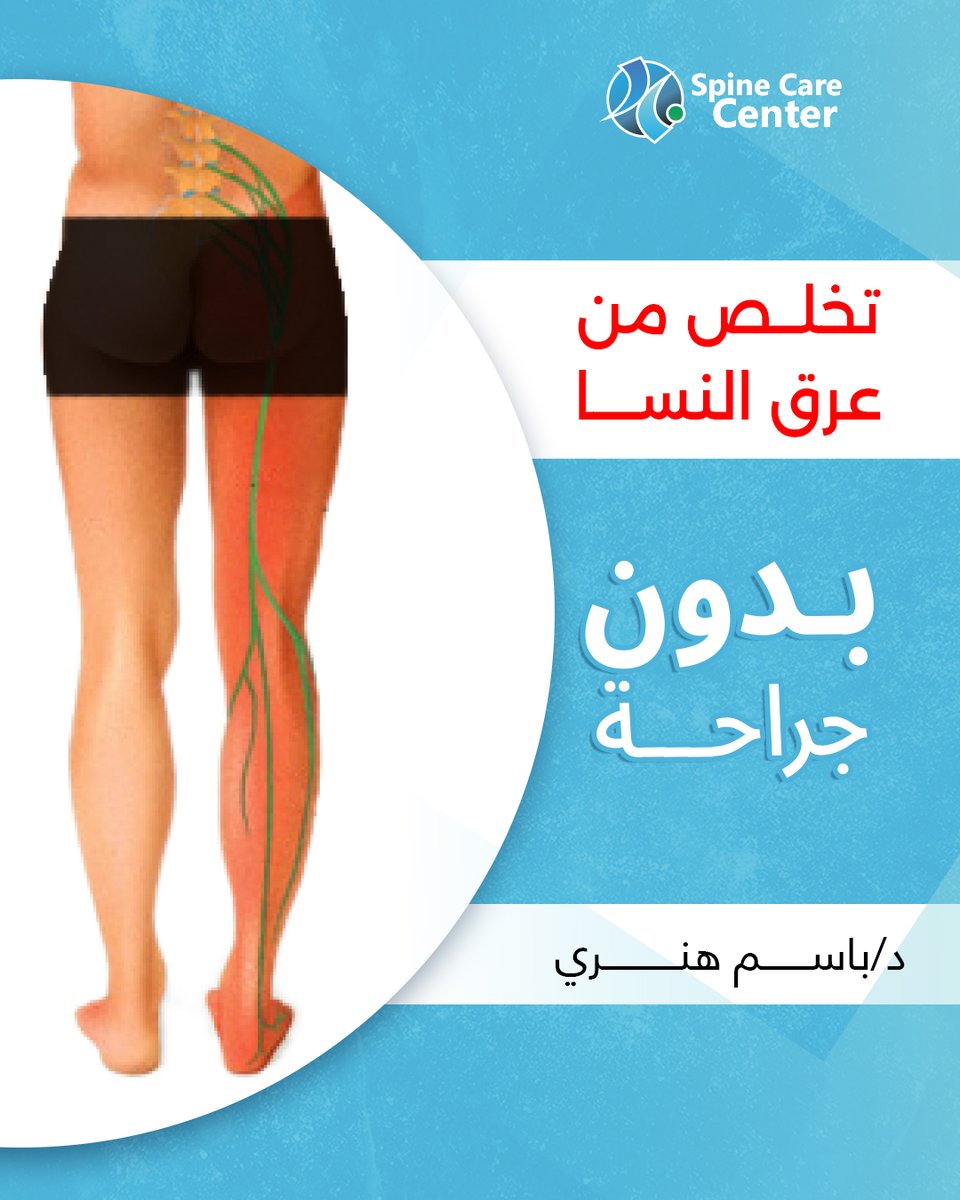عندك عرق النسا ؟؟
دلوقتي عن طريق عمليات التدخل المحدود
تخلص من مشاكل وألم العمود الفقري بدون جراحة وبالتخدير الموضعي