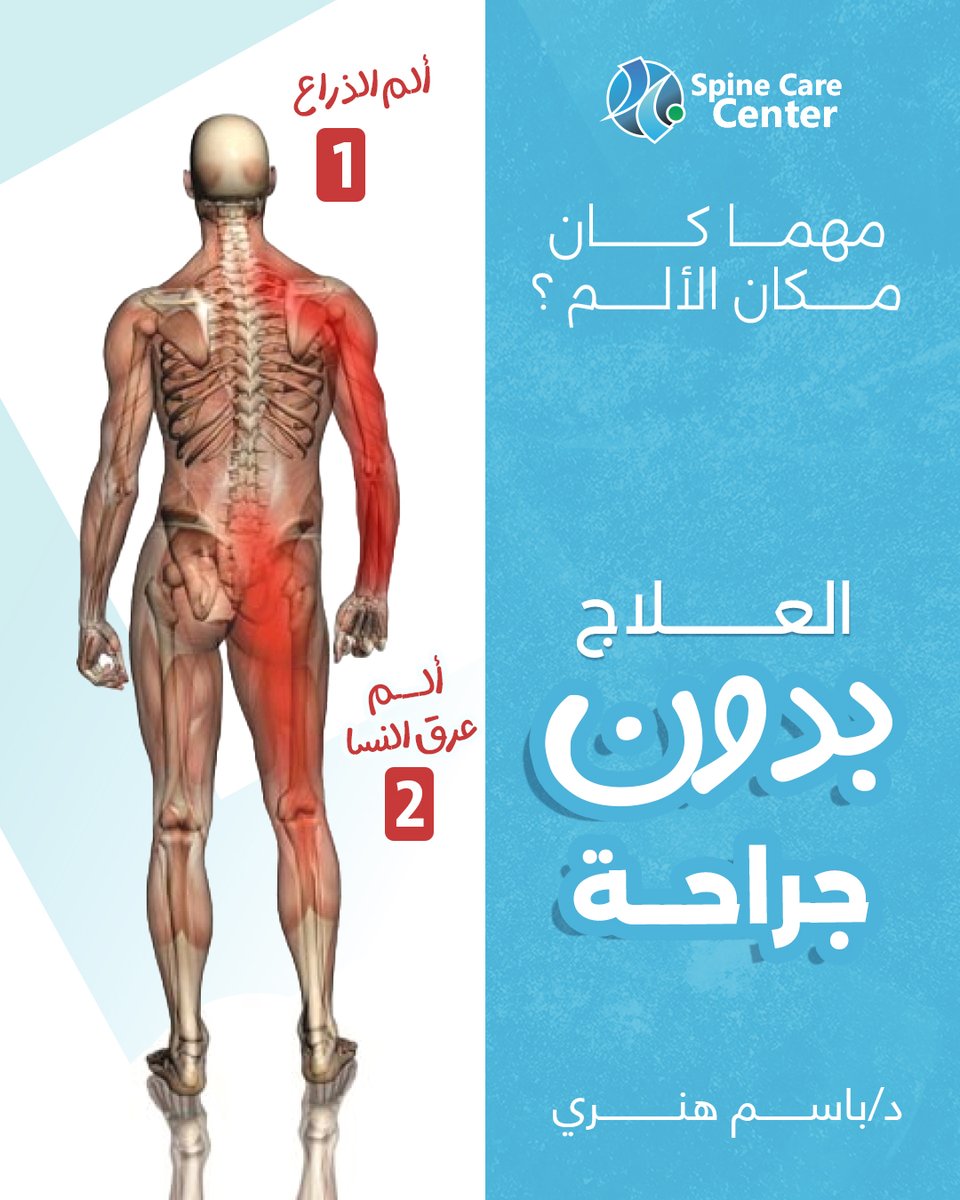 مهما كان مكان الألم 
تواصل معنا واكتب مكان الألم
واحنا هنساعدك تتخلص من مشاكل العمود الفقري 
بدون جراحة - عن طريق عمليات التدخل المحدود