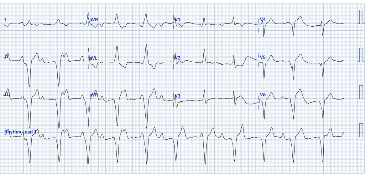 Jack Cahill tweet media