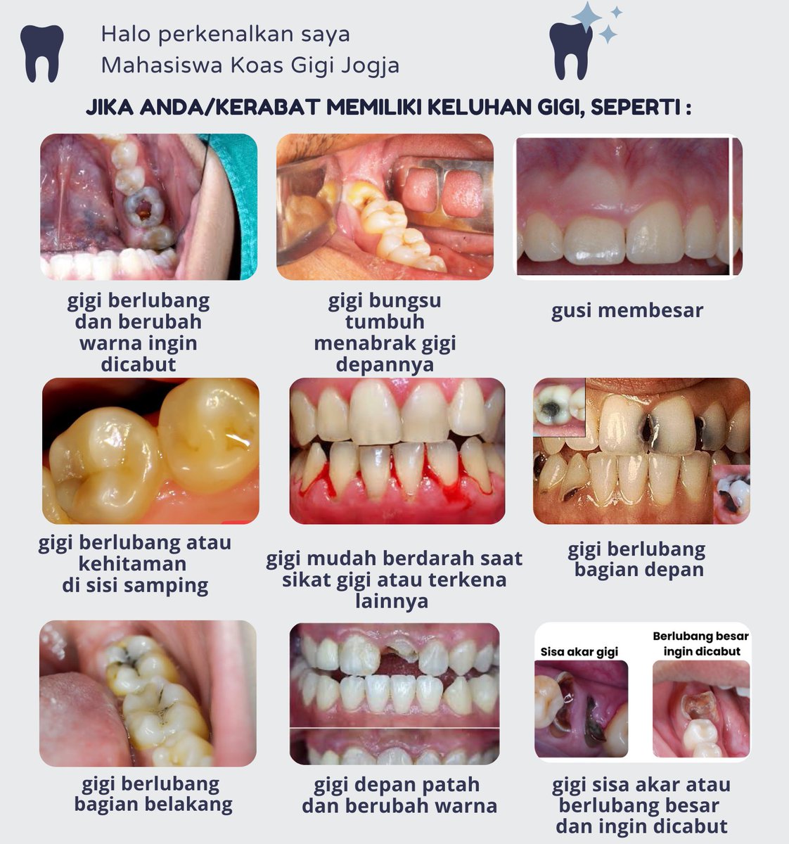 koas gigi jogja✨🦷 CARI PASIEN DM 🙏🏻 tweet media