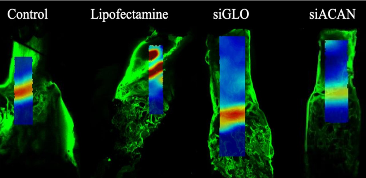 Transiently inhibiting aggrecan using siRNA reduces strain concentrations at the interface of bone and tissue engineered meniscus
