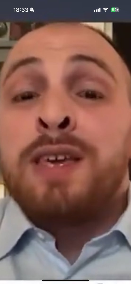 extazdruzy's tweet photo. @mvalet_officiel Tema la taille des narines  🤯 
On peut faire rentrer un Boeing 737 facile. https://t.co/ksnrIixTRO