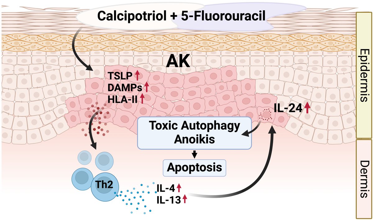 Shawn Demehri (@caimmunoprevent) on Twitter photo Topical immunotherapy activates CD4+ T helper 2 (Th2) immunity to eliminate precancerous skin lesions and prevent cancer. Fantastic work by Dr. Tomonori Oka
<a href="/TomonoriOka1/">Tomonori Oka</a> and Colleagues #Immunoprevention #Th2Immunity #Cancerprevention
<a href="/jclinicalinvest/">Journal of Clinical Investigation</a>
jci.org/articles/view/… Topical immunotherapy activates CD4+ T helper 2 (Th2) immunity to eliminate precancerous skin lesions and prevent cancer. Fantastic work by Dr. Tomonori Oka
<a href="/TomonoriOka1/">Tomonori Oka</a> and Colleagues #Immunoprevention #Th2Immunity #Cancerprevention
<a href="/jclinicalinvest/">Journal of Clinical Investigation</a>
jci.org/articles/view/…