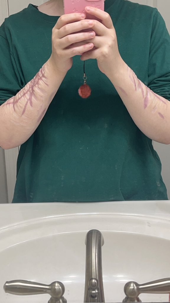 aheartlikegrave's tweet photo. Do you think they’ll notice my scars?, ): https://t.co/xyyJFWuglW