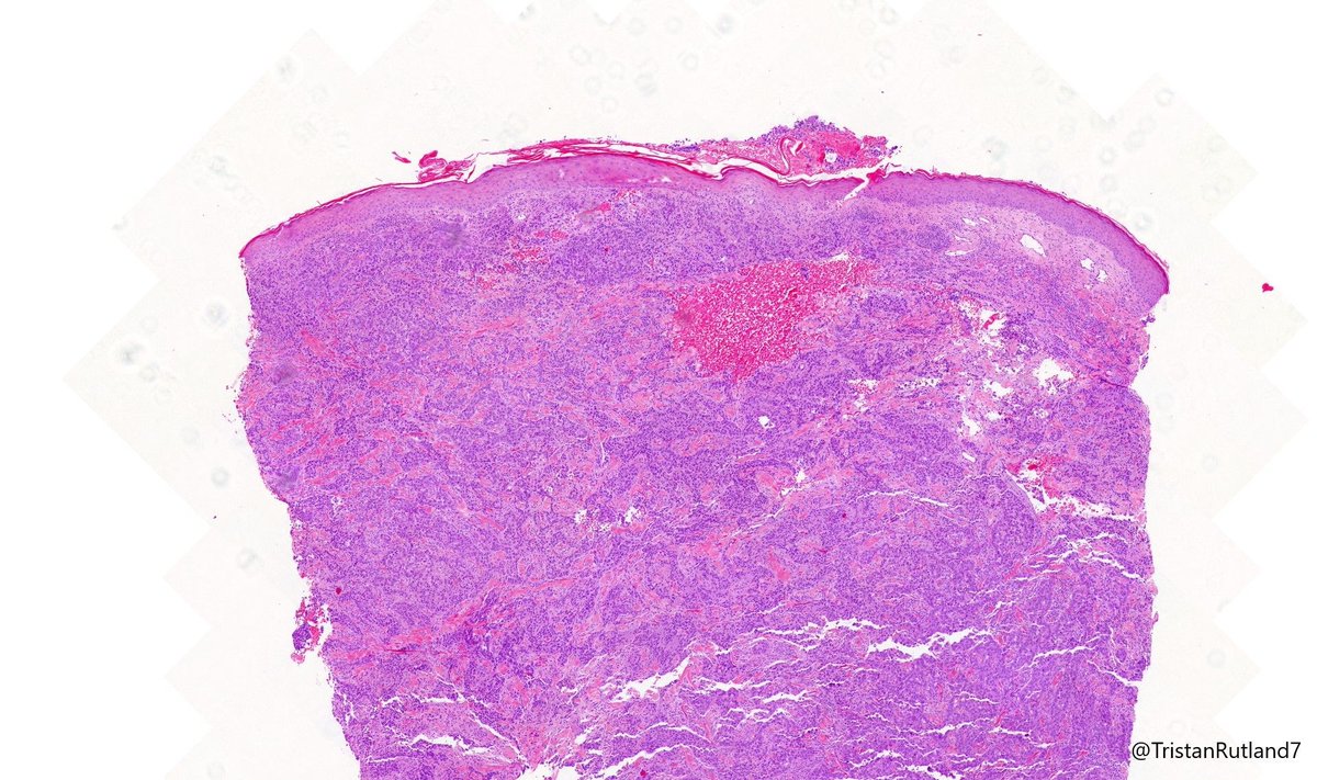 Tristan Rutland MBBS FRCPA IFCAP tweet media