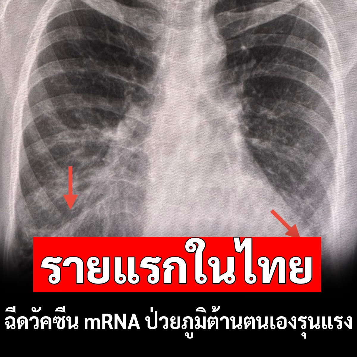 แนวหน้าออนไลน์ tweet media