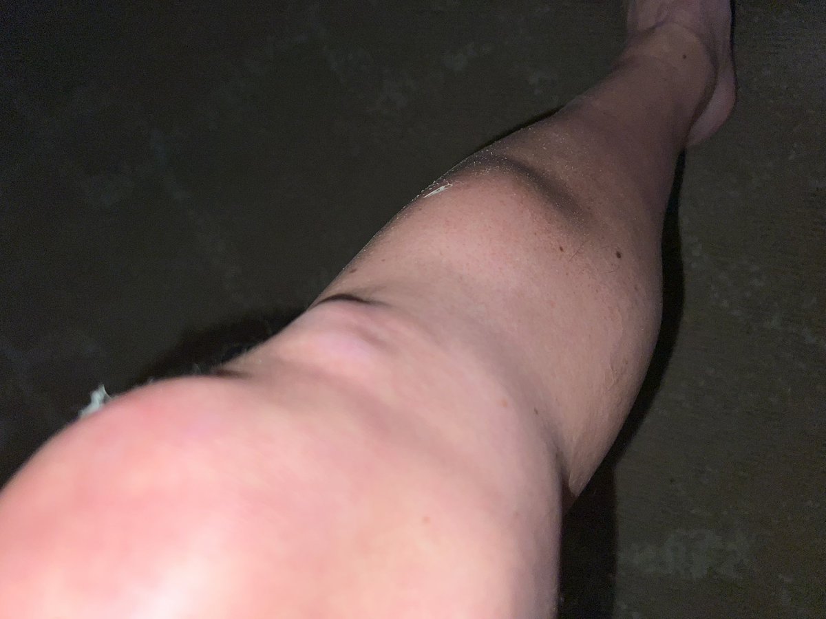 GoScottB's tweet image. PSA warning, if you are ever in @CityofJax for a game @EverBankStadium  DO NOT take the rickshaw!!!   Our guy went over the walking bridge, crashed 2x, I almost broke my leg and my wife may have a broken hand.