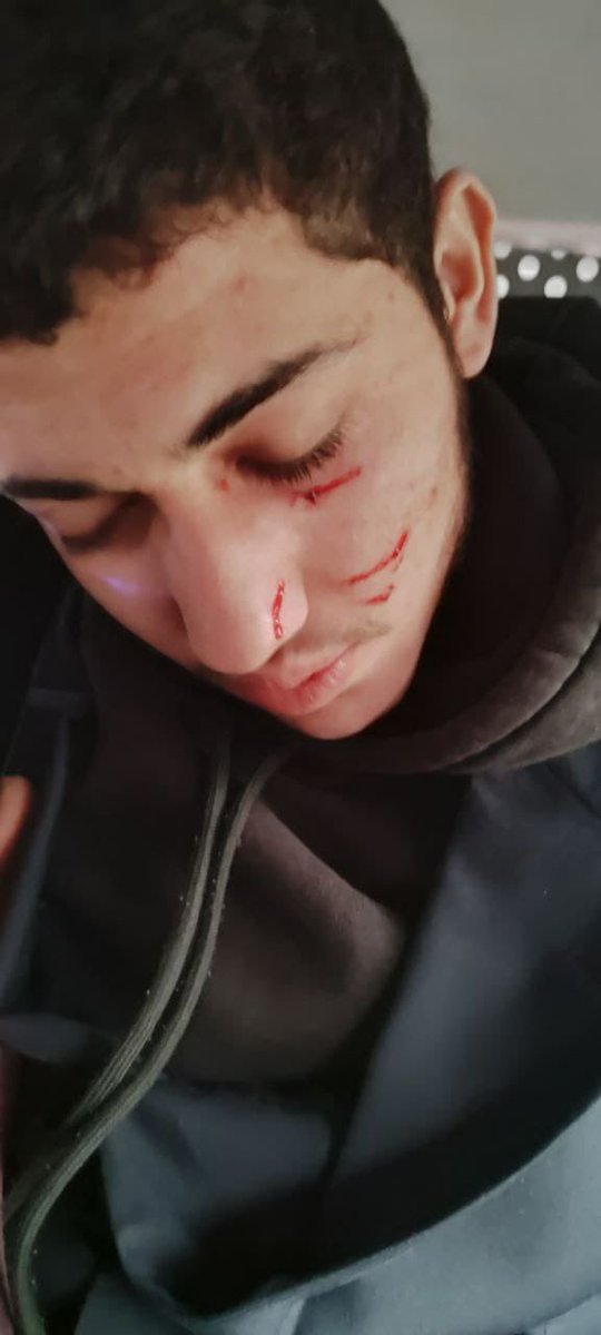 Yazıklar olsun bu nasıl bir kindir böyle!!!

Bu gençler size naptı!

Mekkenin Fethi konferansı nasıl bir rahatsızlık vermiş olabilir devlete ki polisi devreye girip acımasızca darp ediyor!!

Yasal işlere yasal olmayan müdahaleler ne kadar normalleşti memlekette..

Bir de her gün