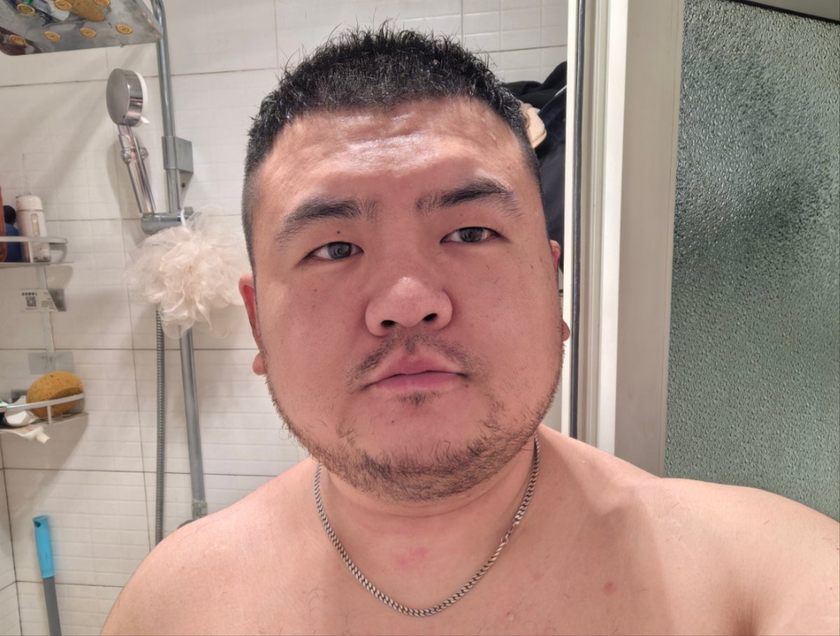 非典型圆脸络腮