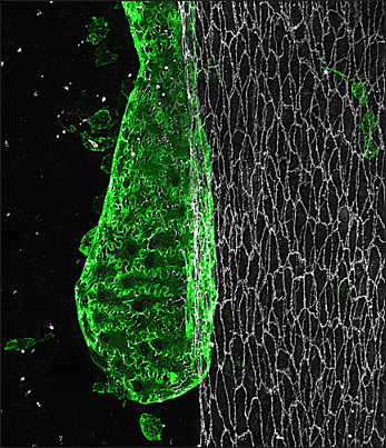Petrova Lab – Vascular and Tumor Biology (@petrovalab) on Twitter photo 🚀Kick off 2025 with exciting studies of #lymphatics🚀
🔬 Centrifugal vs. centripetal origins of LECs
<a href="/StoneOliverA/">oliver stone</a> nature.com/articles/s4416…
🧬 Unveiling lymphatic smooth muscle cell identity
<a href="/PaderaLab/">Padera Lab</a> cell.com/developmental-…
<a href="/SZawieja/">Scott Zawieja</a> elifesciences.org/reviewed-prepr… 🚀Kick off 2025 with exciting studies of #lymphatics🚀
🔬 Centrifugal vs. centripetal origins of LECs
<a href="/StoneOliverA/">oliver stone</a> nature.com/articles/s4416…
🧬 Unveiling lymphatic smooth muscle cell identity
<a href="/PaderaLab/">Padera Lab</a> cell.com/developmental-…
<a href="/SZawieja/">Scott Zawieja</a> elifesciences.org/reviewed-prepr…