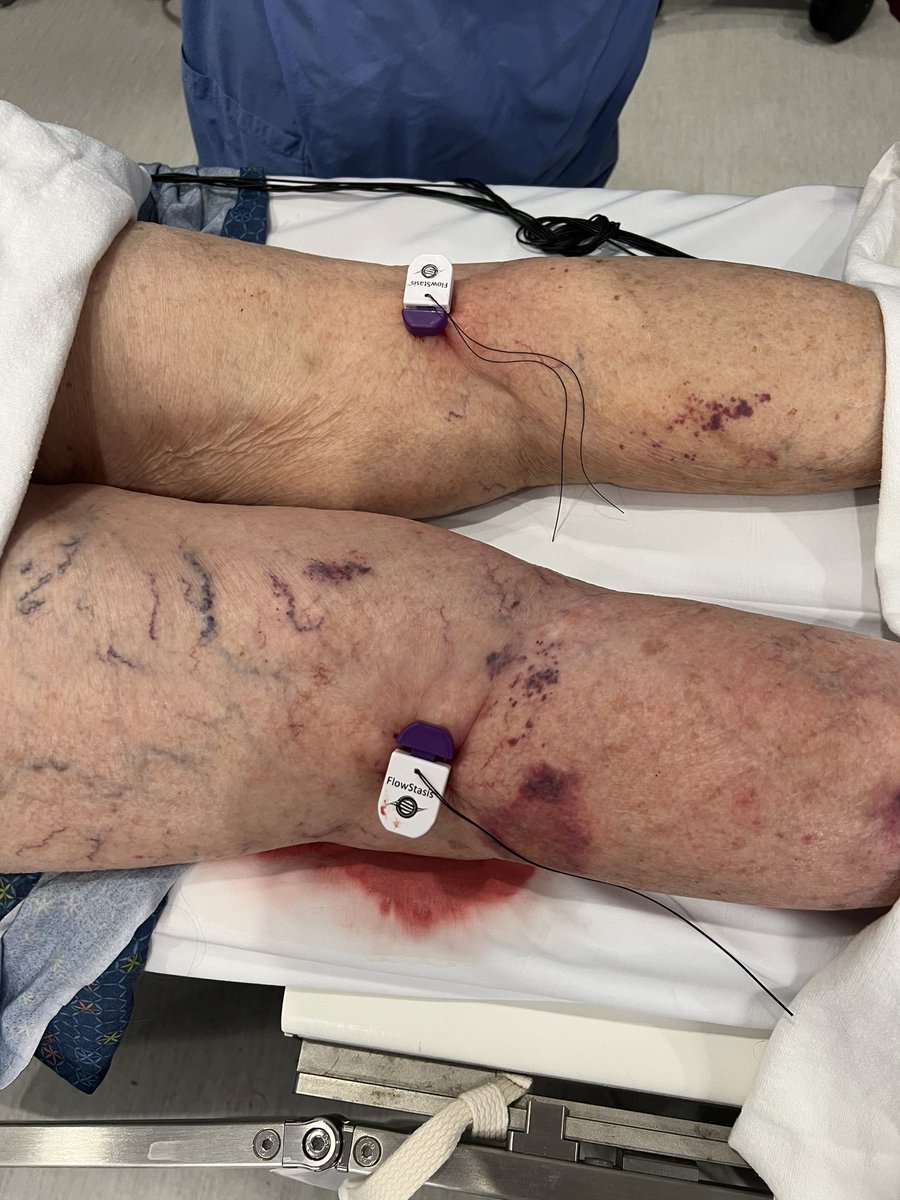 Jay Mohan, D.O., FACC, FSCAI, FASE, RPVI tweet media