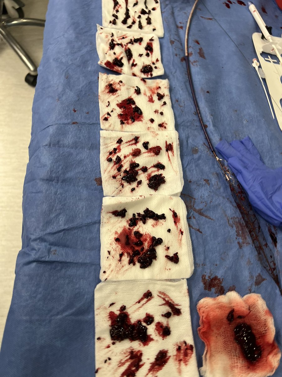 Jay Mohan, D.O., FACC, FSCAI, FASE, RPVI tweet media