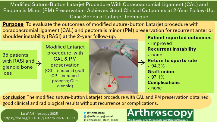 ArthroscopyJ's tweet image. Check out this case series of a modified suture button Latarjet technique with 2-year follow-up. ow.ly/yK0b50Ux2Vq #shoulderinstability #Latarjet #patientoutcomes