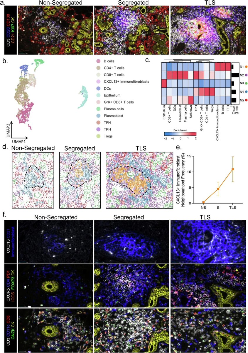 Waggoner Lab (@labwaggoner) on Twitter photo Molecular and spatial analysis of tertiary lymphoid structures in Sjogren’s syndrome
nature.com/articles/s4146…
<a href="/NatureComms/">Nature Communications</a> <a href="/baroneExpMed/">Francesca Barone</a> Molecular and spatial analysis of tertiary lymphoid structures in Sjogren’s syndrome
nature.com/articles/s4146…
<a href="/NatureComms/">Nature Communications</a> <a href="/baroneExpMed/">Francesca Barone</a>