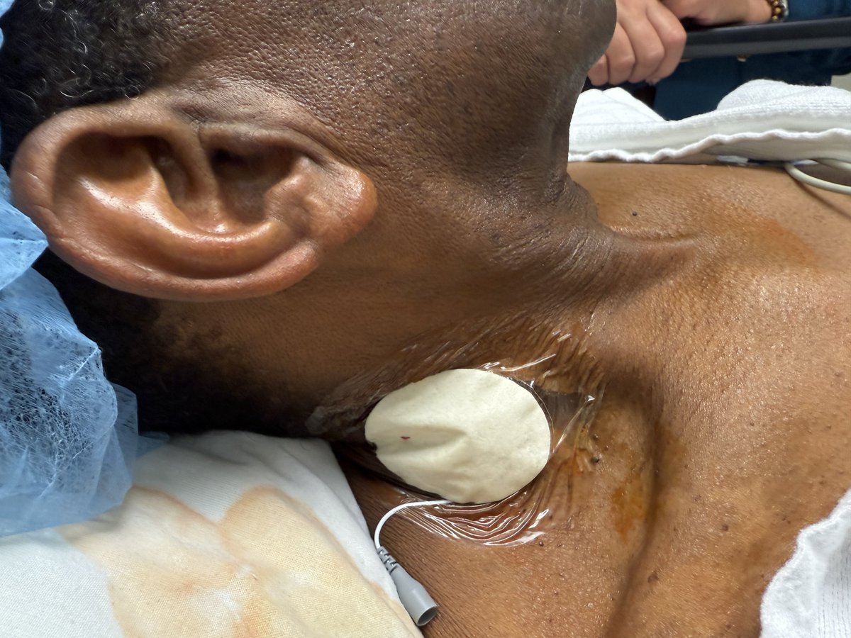 Arun Kalava MD, EDRA tweet media