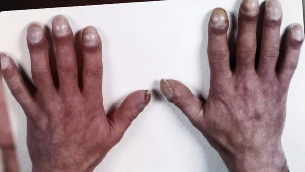 Yaba gibi eli olup takma tirnak takan kizlar temsili 🫨