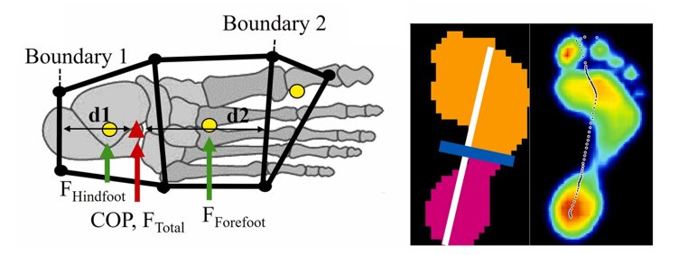 Karen Kruger (@karenkrugerphd) on Twitter photo The first paper from PhD student <a href="/MaxineOlson27/">Maxine Olson</a> is out. She developed an algorithm to distribute a ground reaction force into multiple vectors to allow for calculation of midfoot and ankle moments using standard clinical gait lab equipment.
sciencedirect.com/science/articl…
<a href="/MU_MCW_BME/">Marquette & MCW Joint Dept. of Biomedical Eng.</a> The first paper from PhD student <a href="/MaxineOlson27/">Maxine Olson</a> is out. She developed an algorithm to distribute a ground reaction force into multiple vectors to allow for calculation of midfoot and ankle moments using standard clinical gait lab equipment.
sciencedirect.com/science/articl…
<a href="/MU_MCW_BME/">Marquette & MCW Joint Dept. of Biomedical Eng.</a>