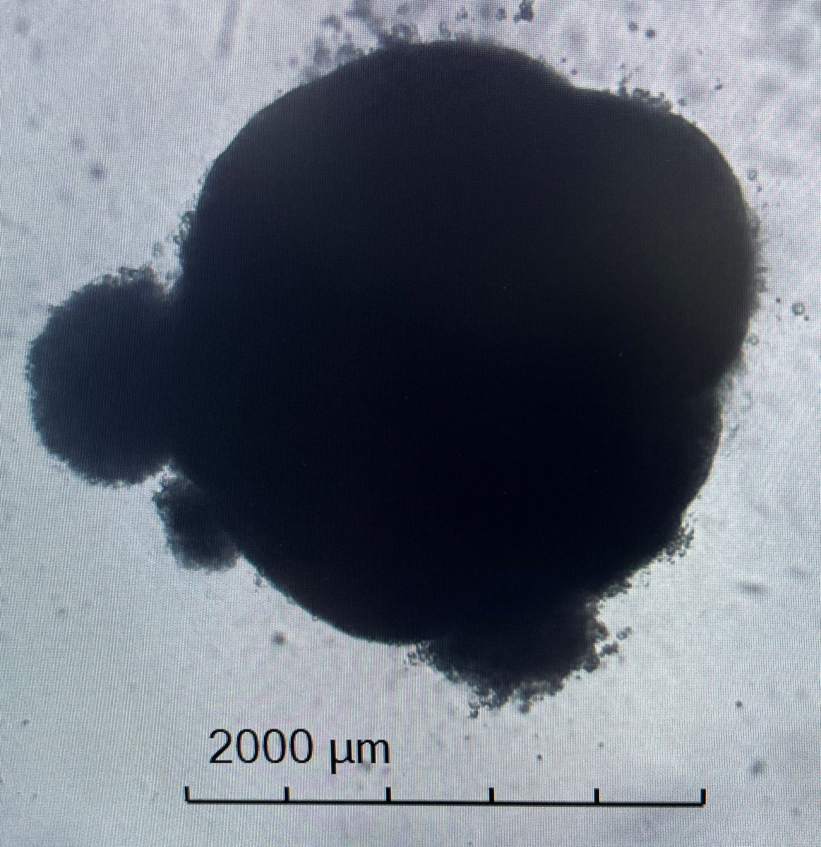 SevdeAltuntas's tweet image. Bugün de @SBUDETUAM&apos;da deri organoidleri ile uğraşıyoruz. Sevgili doktora öğrencim Seyfure bin bir emekle büyütüyor dokuları. 150 günlük doku kültürleme süresini yılın ilk çeyreğinde tamamlayabilmek ümidiyle. Herkese iyi akşamlar #devam #AltuntasLab #TUBITAK1004