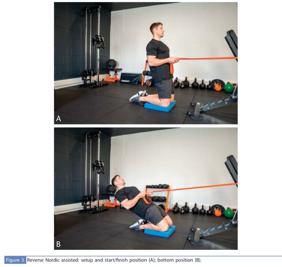 Anthony Weldon (PhD) (@dranthonyweldon) on Twitter photo Our paper “Exercise Technique - The Reverse Nordic” is available at <a href="/NSCASCJonline/">Strength and Conditioning Journal</a>
Thanks to all co-authors 👊
<a href="/GarethSapstead/">Gareth Sapstead</a> <a href="/TomDosSantos91/">Tom Dos'Santos</a> <a href="/TommyEliBright/">Tommy Bright</a> <a href="/MarcoBeato1/">Dr Marco Beato</a> & Merrick Lincoln.
Access using below links:
SCJ: shorturl.at/aPrFs
RG: shorturl.at/ffNXc Our paper “Exercise Technique - The Reverse Nordic” is available at <a href="/NSCASCJonline/">Strength and Conditioning Journal</a>
Thanks to all co-authors 👊
<a href="/GarethSapstead/">Gareth Sapstead</a> <a href="/TomDosSantos91/">Tom Dos'Santos</a> <a href="/TommyEliBright/">Tommy Bright</a> <a href="/MarcoBeato1/">Dr Marco Beato</a> & Merrick Lincoln.
Access using below links:
SCJ: shorturl.at/aPrFs
RG: shorturl.at/ffNXc