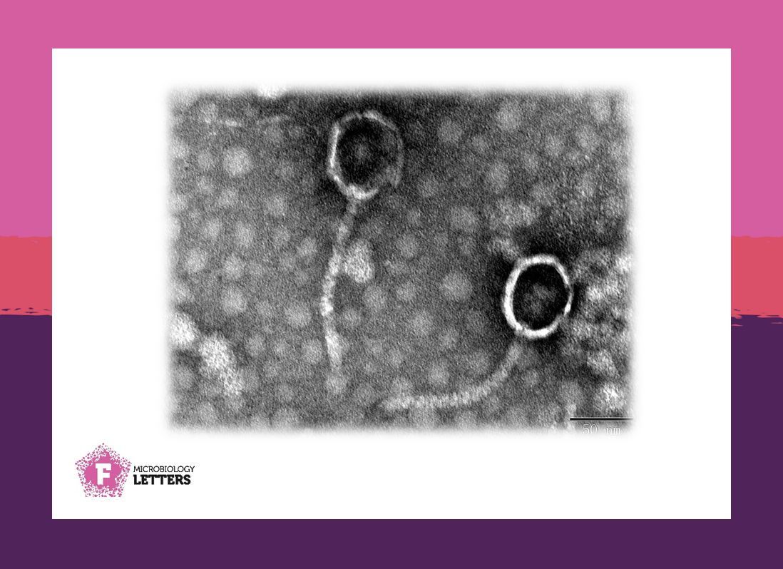 FEMSmicro's tweet image. New phage alert! 📣🧬🦠 
Hou et al. isolate and characterize phage BUCT627, showing promise as a targeted therapy against Stenotrophomonas infections. Don’t miss the beautiful microscopy image 🔬!
 #FEMSMicrobiolLett #PhageTherapy #AntibioticResistance 

academic.oup.com/femsle/article…