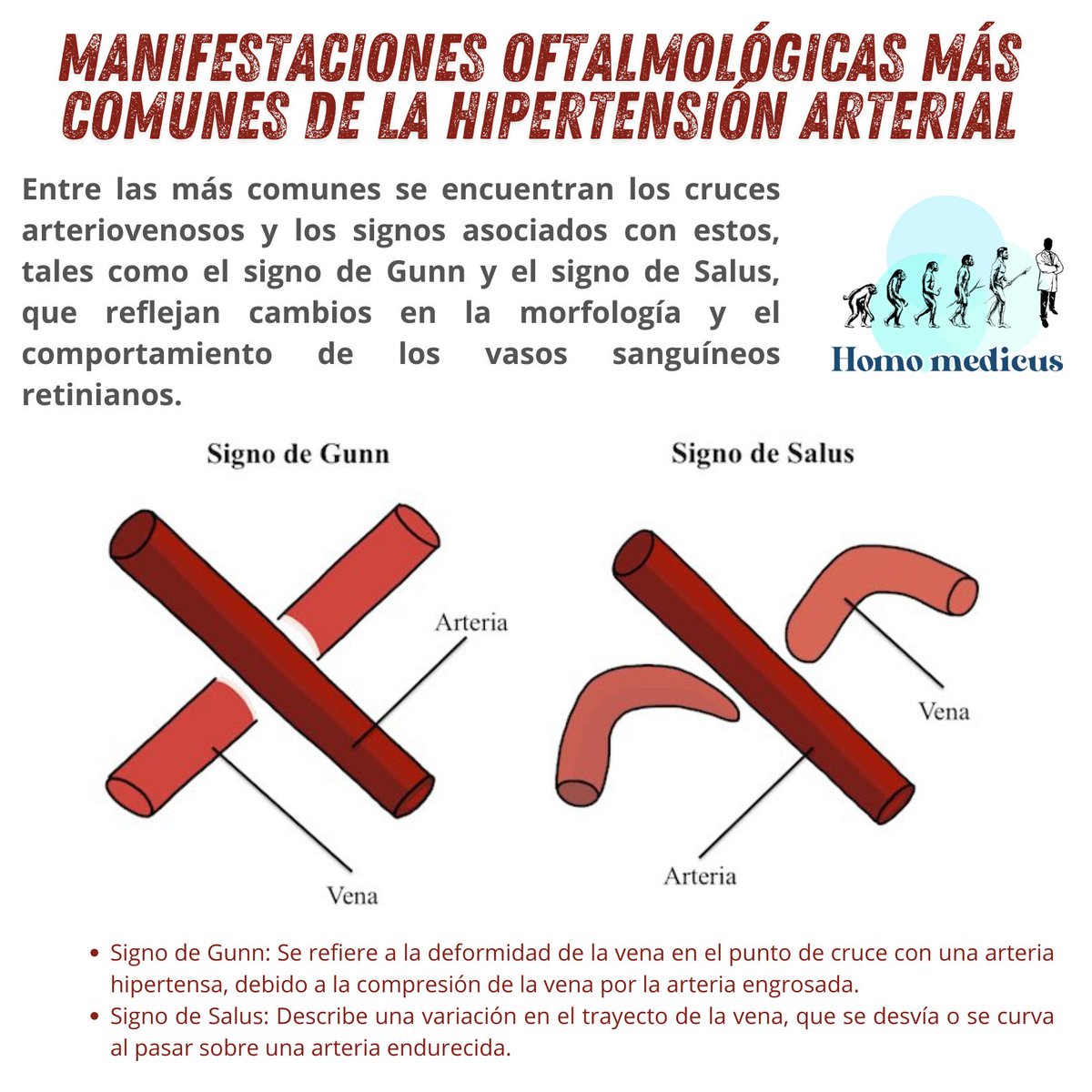 🌀MANIFESTACIONES  OFTALMOLÓGICAS  DE  LA  HIPERTENSIÓN  ARTERIAL

#ENARM_INTENSIVO #ENARM2025 #ENARM