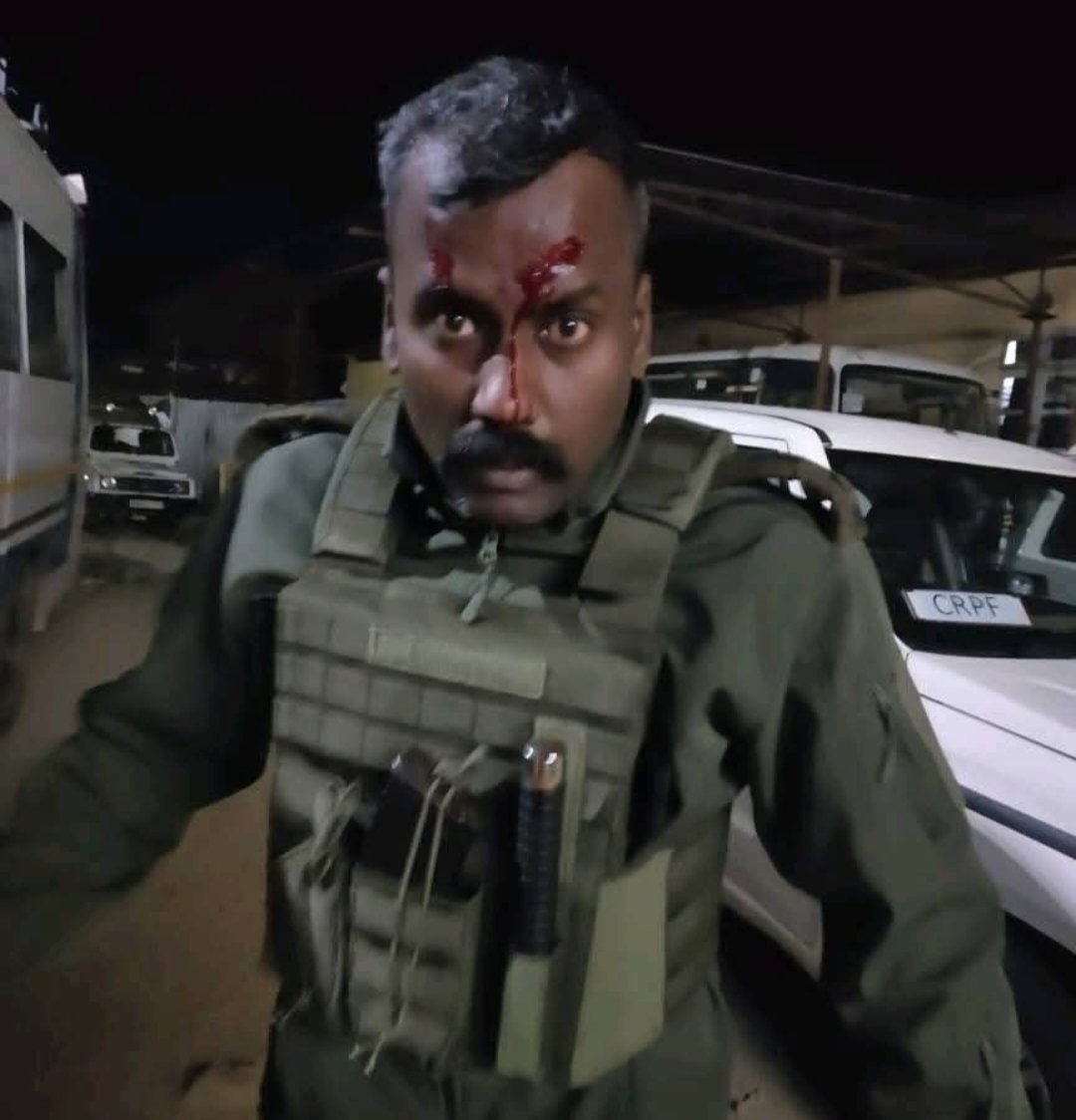 SP KPI Manoj Prabhakar injured in a violent attack carried out by Kuki.