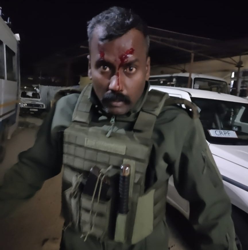 Imagine if it's a bullet injury instead of stones. SP of Kangpokpi district, Manipur Mr. Manoj Prabhakar, IPS got injured in the attack by armed kuki militants. #IndiaUnderAttack

<a href="/CNNnews18/">News18</a> <a href="/IndianExpress/">The Indian Express</a> <a href="/timesofindia/">The Times Of India</a> <a href="/the_hindu/">The Hindu</a> <a href="/ABPNews/">ABP News</a> <a href="/BBCBreaking/">BBC Breaking News</a>