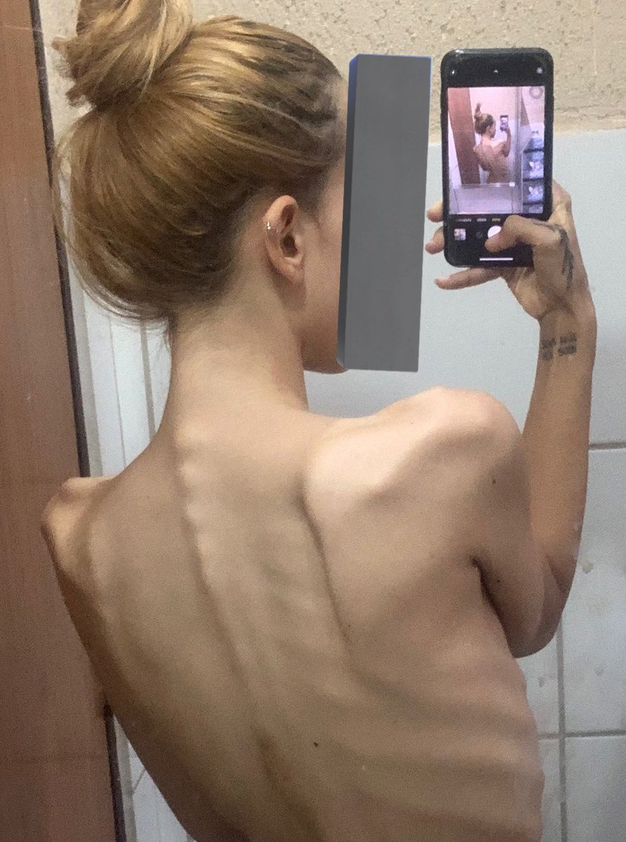 notsick89's tweet photo. retrospectiva do pior ano da minha vida em relação a minha saude mental

adeus 2024, você tentou muito mas eu sobrevivi! https://t.co/ii42ezTCzb
