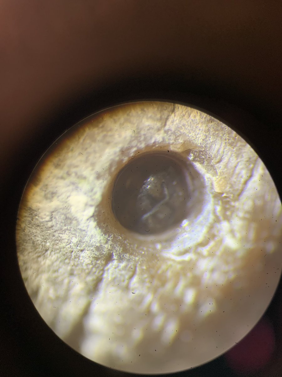 Matthew W. Gray π π¬ (@mattwgray) on Twitter photo Sweden is snowy and itβs time to probe some snail brood pouches Sweden is snowy and itβs time to probe some snail brood pouches