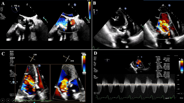 Journal of Invasive Cardiology tweet media