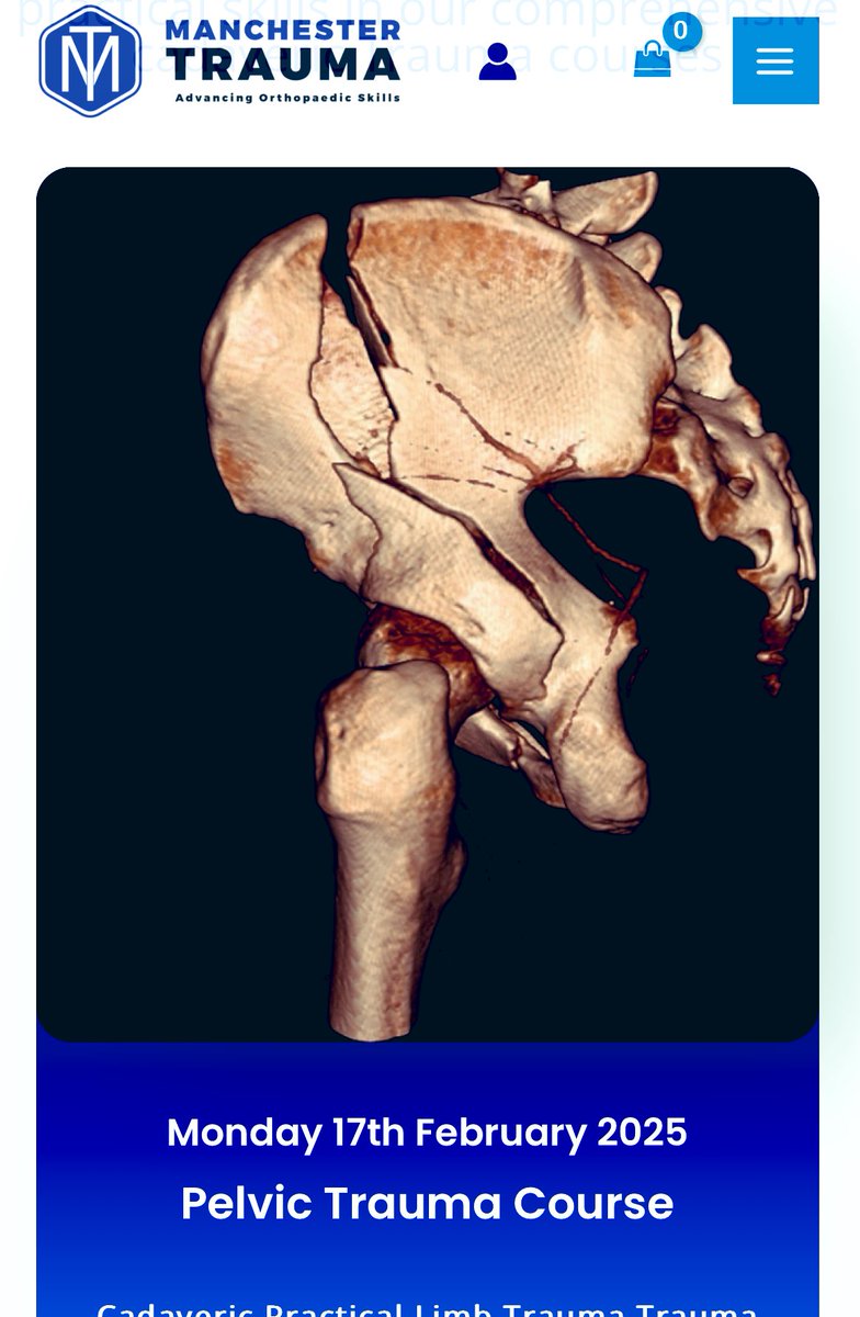 Joseph Alsousou (@josephalsousou) on Twitter photo Manchester Pelvic Trauma course 17 feb 2025 registration is open. Book your place now
manchestertrauma.com
Limited spaces
Practical cadaveric pelvis & acetabulum fixation <a href="/MSSSC_/">Manchester Surgical Skills and Simulation Centre</a> <a href="/MajorTraumaMRI/">Major Trauma Centre - Manchester Royal Infirmary</a> <a href="/MFT_MRI/">Manchester Royal Infirmary</a> <a href="/MFTnhs/">MFT NHS</a>
<a href="/OTrauma/">Orthopaedic Trauma</a> <a href="/BritOrthopaedic/">BOA</a> <a href="/bota_uk/">BOTA</a> <a href="/BAPAS_UK/">British Association of Pelvic & Acetabular Surgeon</a>
Excellent Manchester Pelvic Trauma course 17 feb 2025 registration is open. Book your place now
manchestertrauma.com
Limited spaces
Practical cadaveric pelvis & acetabulum fixation <a href="/MSSSC_/">Manchester Surgical Skills and Simulation Centre</a> <a href="/MajorTraumaMRI/">Major Trauma Centre - Manchester Royal Infirmary</a> <a href="/MFT_MRI/">Manchester Royal Infirmary</a> <a href="/MFTnhs/">MFT NHS</a>
<a href="/OTrauma/">Orthopaedic Trauma</a> <a href="/BritOrthopaedic/">BOA</a> <a href="/bota_uk/">BOTA</a> <a href="/BAPAS_UK/">British Association of Pelvic & Acetabular Surgeon</a>
Excellent