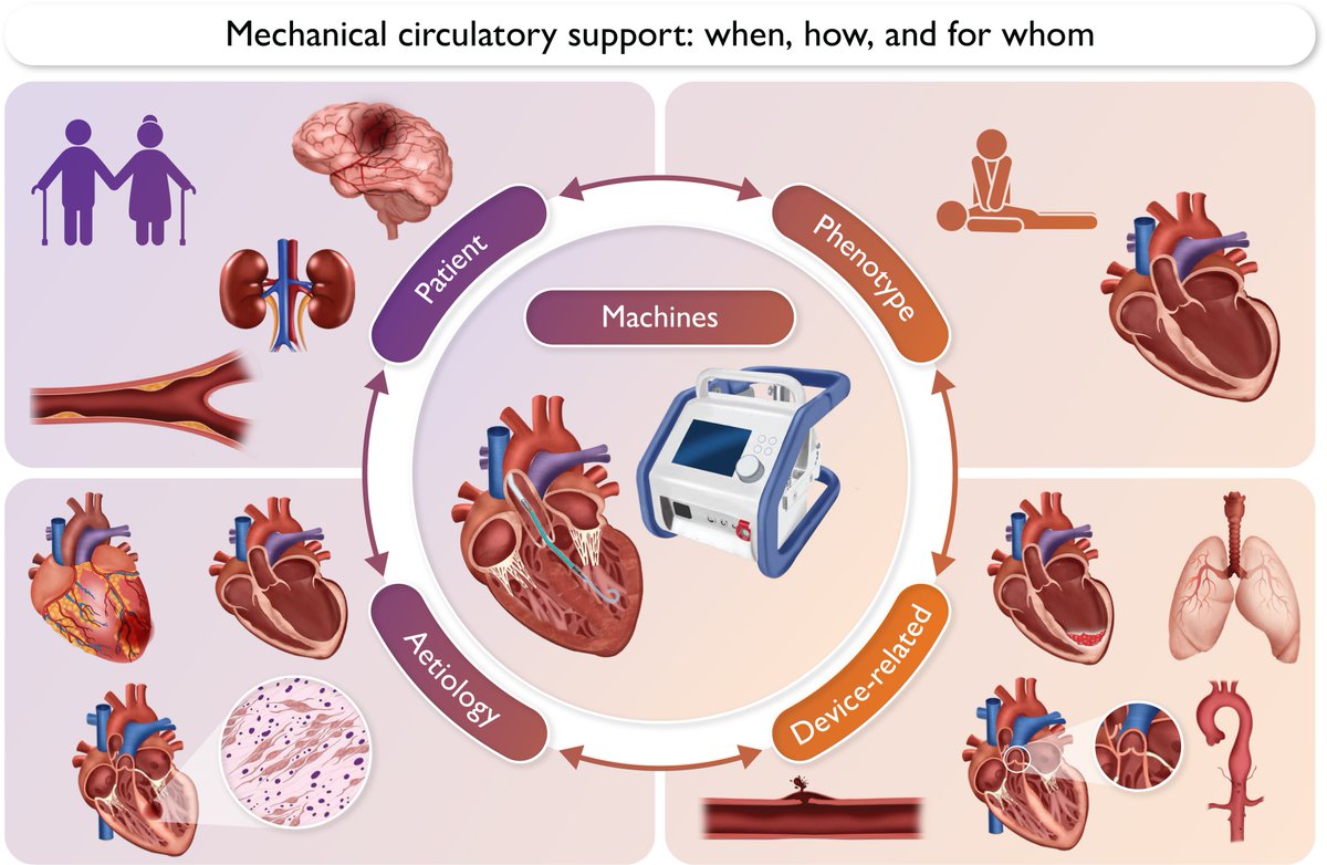 Timing is key for temporary mechanical circulatory support in cardiogenic shock patients. Device selection (IABP, pVADs, V-A ECMO) must be tailored to patient needs. Read more in #EHJ
doi.org/10.1093/eurhea…
#HeartFailure #shock #MCS #cardiotwitter <a href="/ESC_Journals/">European Society of Cardiology Journals</a> <a href="/escardio/">European Society of Cardiology</a>