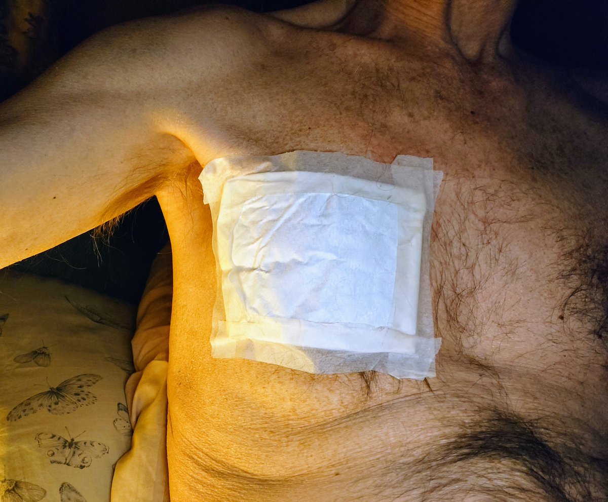 Silverray10's tweet image. Hiya. Heat Pad in place to alleviate my few cracked ribs. Not much fun coughing this hard as I am prone to breaking ribs. Hurts like crazy. Take Care. Love you both lots. 👍😀 xxxx