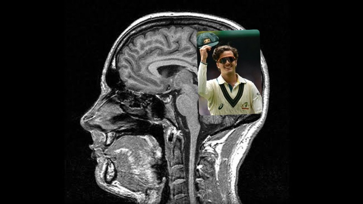 bradfogarty101's tweet image. Jasprit Bumrah’s scans have just come back. 

Hope he’s ok

#AUSvIND