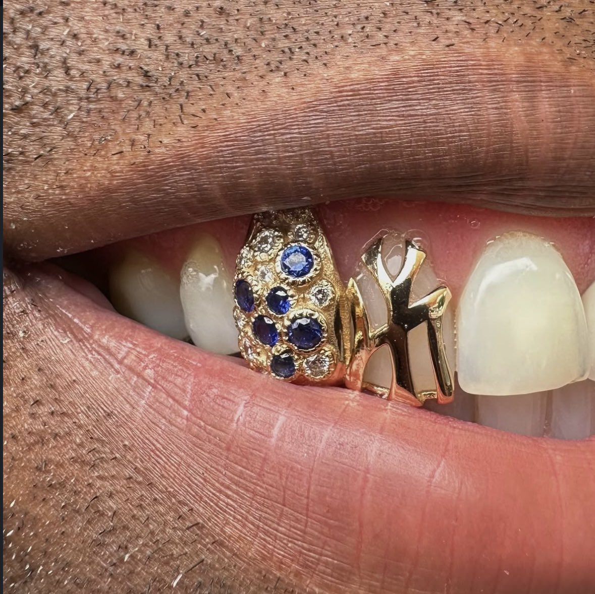 NIYMUSE's tweet photo. Grillz by Fineassfronts https://t.co/0L417LBXCP