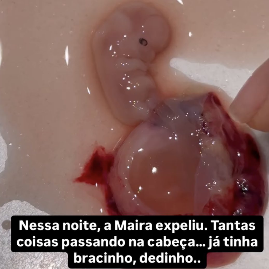 choquei's tweet photo. 🚨FAMOSOS: Thiago Nigro, marido de Maíra Cardi, posta foto de feto após aborto espontâneo da influenciadora. https://t.co/PlC9PKsfmq