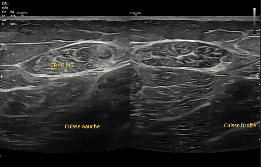 No SuperDoc tweet media