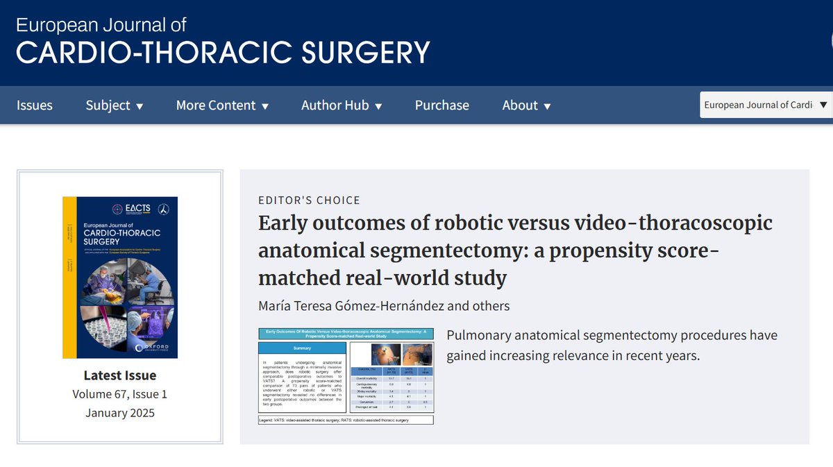 Teresa Gómez (@teresagh) on Twitter photo Thrilled that our article on robotic vs. VATS segmentectomies has been selected as the Editor's Choice for January in the EJCTS! #RoboticSurgery #VATS #ThoracicSurgery <a href="/EACTS_Journals/">EJCTS_ICVTS</a> <a href="/ForcadaClara/">Clara Forcada</a> <a href="/mehlikaiscan/">Op. Dr. Mehlika İşcan</a> <a href="/toracicaslm/">Cirugía Torácica Salamanca</a> Thrilled that our article on robotic vs. VATS segmentectomies has been selected as the Editor's Choice for January in the EJCTS! #RoboticSurgery #VATS #ThoracicSurgery <a href="/EACTS_Journals/">EJCTS_ICVTS</a> <a href="/ForcadaClara/">Clara Forcada</a> <a href="/mehlikaiscan/">Op. Dr. Mehlika İşcan</a> <a href="/toracicaslm/">Cirugía Torácica Salamanca</a>