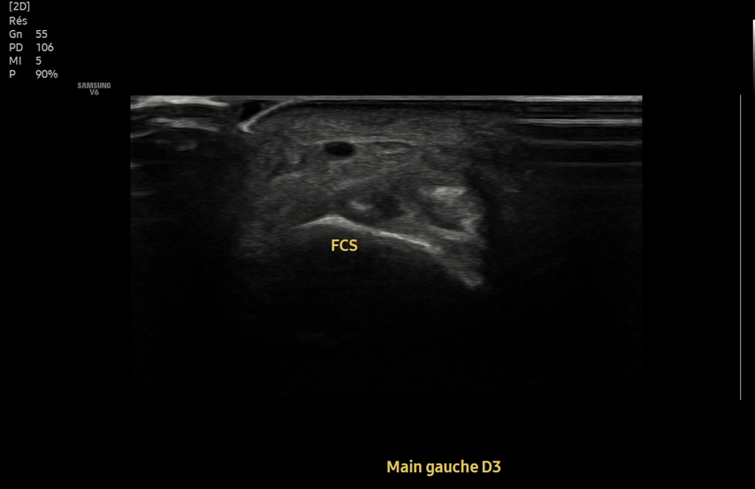 No SuperDoc tweet media