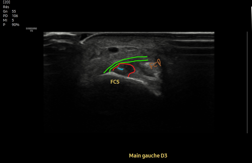 No SuperDoc tweet media