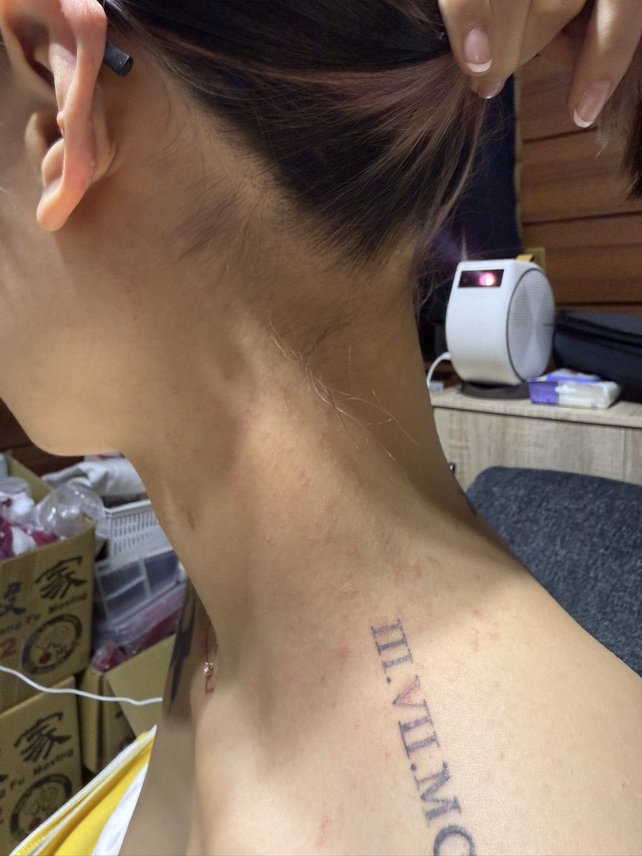 有人知道這是什麼皮膚病嗎
假日診所沒開打算禮拜一就去看🥹 https://t.co/LyZwwmwjJT