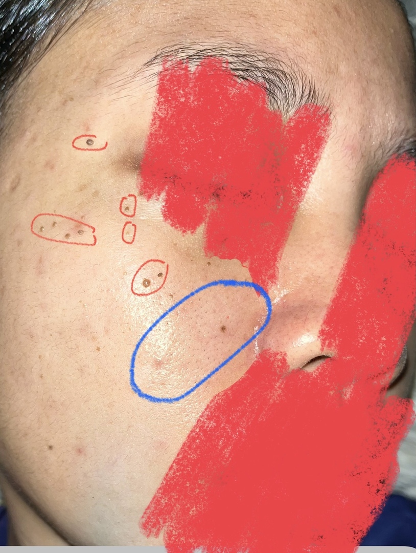 ✨OMBB | 🚫NO LINK tweet media