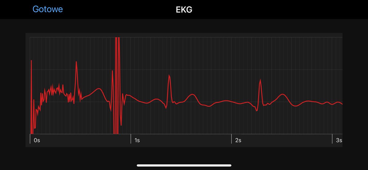 MarekGajACMilan's tweet image. Fajna funkcja w nowym #Garmin #Fenix8 (i nie tylko)
Można sobie mierzyć swoje #EKG
Apka niestety wymaga aktywacji z uwzględnieniem lokalizacji #GPS #USA :/ ale i z tym sobie można poradzić 😎😋 poprzez apke #iMyFoneAnyTo