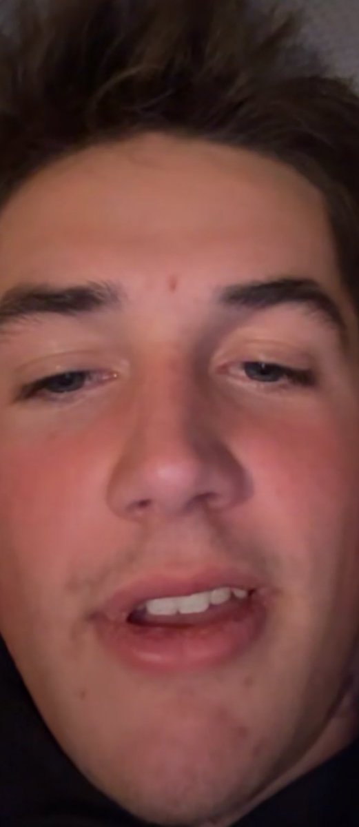 FACE REVEAL🚨🚨 I am proud to announce I Remi Lurkingtin am ran by Skylar Krayneski🙌🙌 Thank you all for the likes!!!