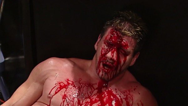 fGuard0's tweet image. Ryan Lindgren on a non called high stick #NYR