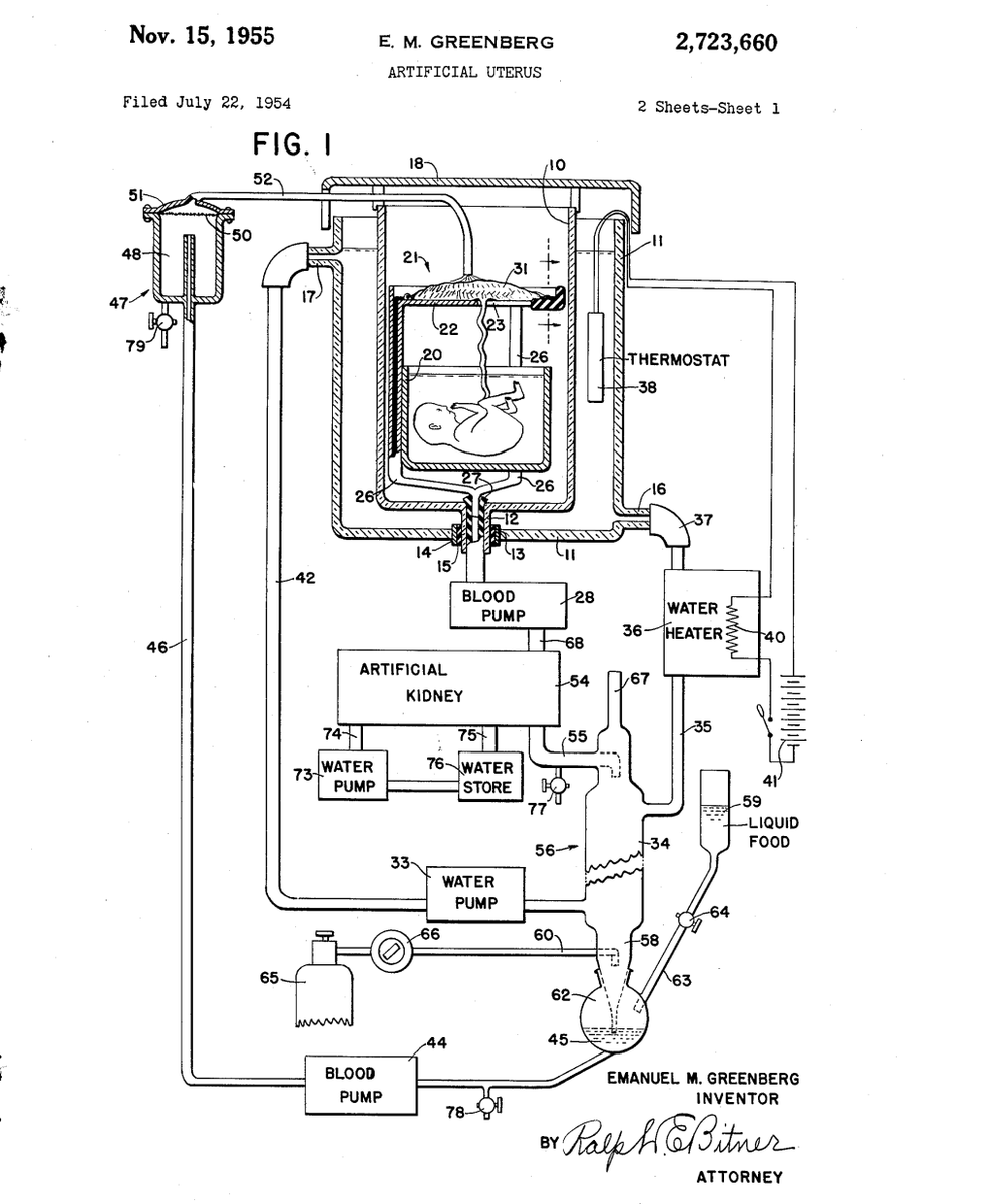 antonioregalado's tweet photo. Technical drawing of an infant gestating inside an artificial womb. 

Emanuel M. Greenberg, ARTIFICIAL UTERUS, U.S. Patent No. 2,723,660 (November 15, 1955) https://t.co/5kxt9EZb3x