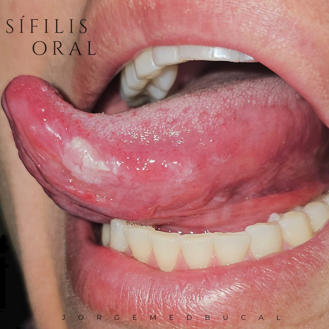 Jorge G. Russo tweet media